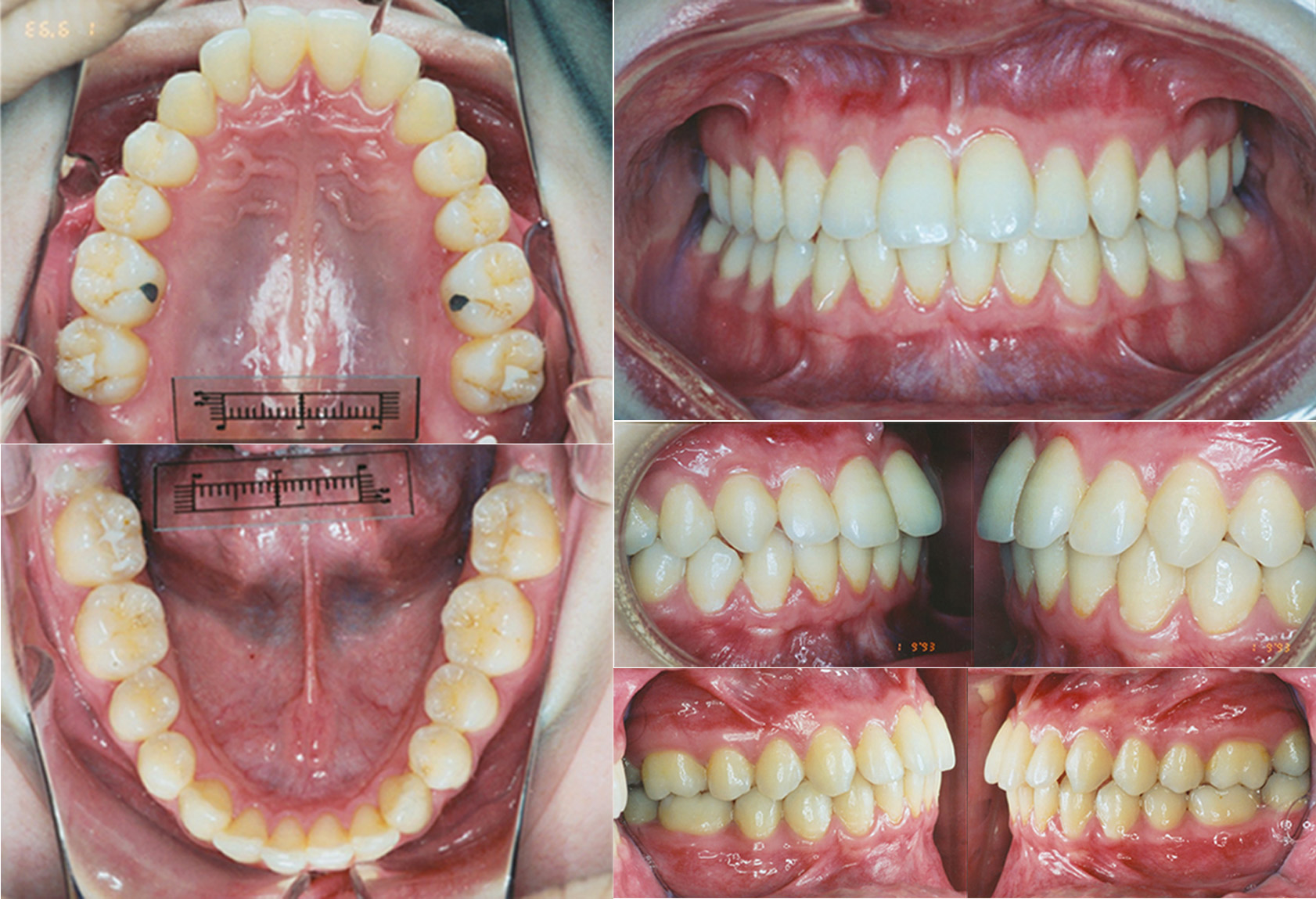 Orthodontic diagnostic photos
